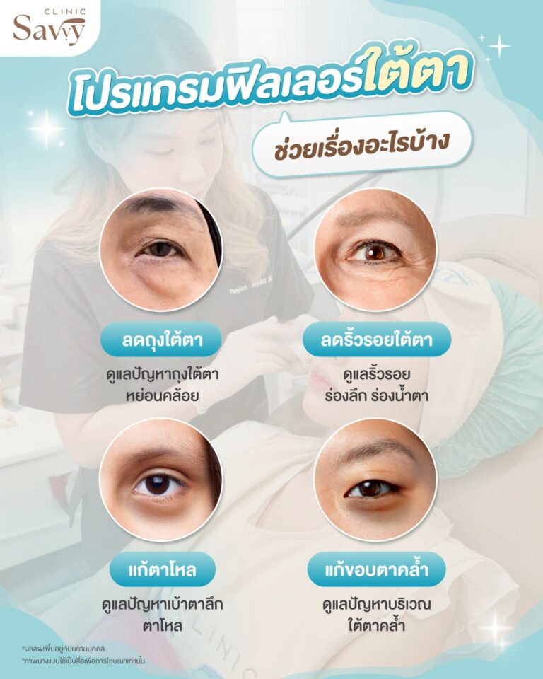 ฟิลเลอร์ใต้ตาช่วยอะไรบ้าง